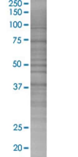 Abnova MK-STYX 293T Cell Transient Overexpression Lysate (Denatured) 100 &mu;L | Buy Online | Abnova&trade; | Fisher Scientific
