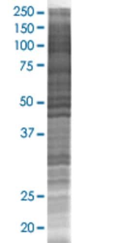 Abnova CGI-38 293T Cell Transient Overexpression Lysate (Denatured) 100 &mu;L | Buy Online | Abnova&trade; | Fisher Scientific