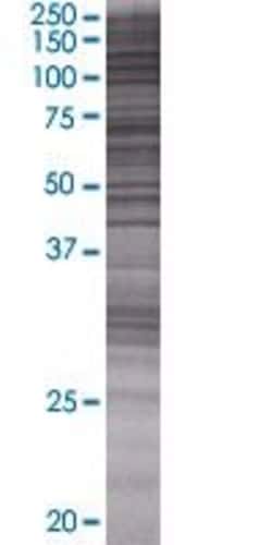 Abnova MYOZ2 293T Cell Transient Overexpression Lysate (Denatured) 100 &mu;L | Buy Online | Abnova&trade; | Fisher Scientific