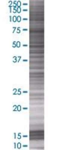 Abnova NUDT9 293T Cell Transient Overexpression Lysate (Denatured) 100 &mu;l | Buy Online | Abnova&trade; | Fisher Scientific