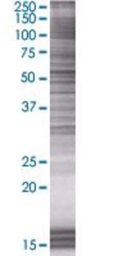 Abnova TERF2IP 293T Cell Transient Overexpression Lysate (Denatured) 100 &mu;L | Buy Online | Abnova&trade; | Fisher Scientific