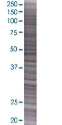 Abnova CCDC76 293T Cell Transient Overexpression Lysate (Denatured) 100 &mu;L | Buy Online | Abnova&trade; | Fisher Scientific