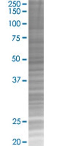 Abnova CROT 293T Cell Transient Overexpression Lysate (Denatured) (T02) 100 &mu;L | Buy Online | Abnova&trade; | Fisher Scientific