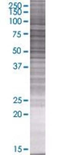 Abnova&trade;&nbsp;CCDC40 293T Cell Transient Overexpression Lysate (Denatured)