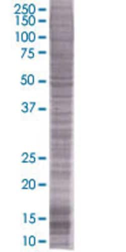 Abnova AGGF1 293T Cell Transient Overexpression Lysate (Denatured) (T04) 100 &mu;L | Buy Online | Abnova&trade; | Fisher Scientific