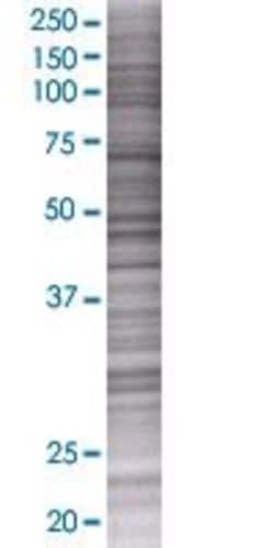 Abnova CRTAC1 293T Cell Transient Overexpression Lysate (Denatured) 100 &mu;L | Buy Online | Abnova&trade; | Fisher Scientific