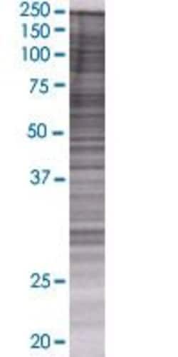 Abnova WDR79 293T Cell Transient Overexpression Lysate (Denatured) (T01) 100 &mu;L | Buy Online | Abnova&trade; | Fisher Scientific