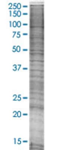 Abnova MRPS10 293T Cell Transient Overexpression Lysate (Denatured) (T03) 100 &mu;l | Buy Online | Abnova&trade; | Fisher Scientific
