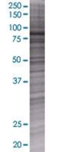 Abnova KLHL11 293T Cell Transient Overexpression Lysate (Denatured) 100 &mu;L | Buy Online | Abnova&trade; | Fisher Scientific