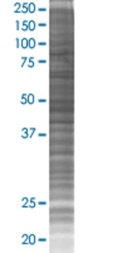 Abnova SMU1 293T Cell Transient Overexpression Lysate (Denatured) (T02) 100 &mu;L | Buy Online | Abnova&trade; | Fisher Scientific
