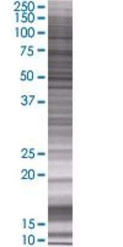 Abnova ADI1 293T Cell Transient Overexpression Lysate (Denatured) (T01) 100 &mu;L | Buy Online | Abnova&trade; | Fisher Scientific