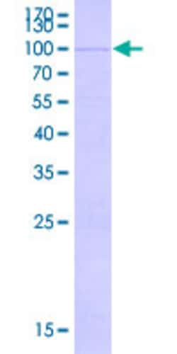 Abnova Human FBXW7 Full-length ORF (BAA91986.1, 1 a.a. - 553 a.a.) Recombinant Protein with GST-tag at N-terminal 2 &mu;g | Buy Online | Abnova&trade; | Fisher Scientific