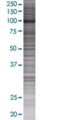 Abnova DHTKD1 293T Cell Transient Overexpression Lysate (Denatured) (T01) 100 &mu;L | Buy Online | Abnova&trade; | Fisher Scientific