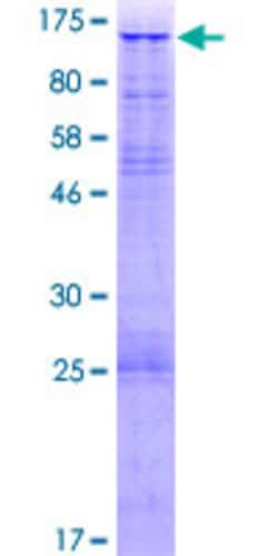 Abnova Human URG4 Full-length ORF (AAH18426.1, 1 a.a. - 856 a.a.) Recombinant Protein with GST-tag at N-terminal 2 &mu;g | Buy Online | Abnova&trade; | Fisher Scientific