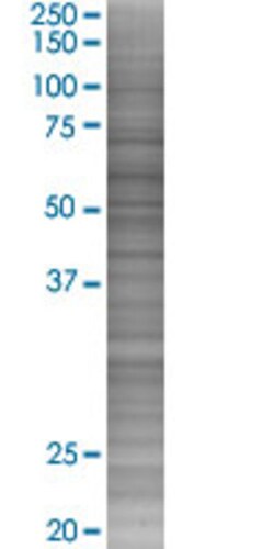 Abnova DNAJC11 293T Cell Transient Overexpression Lysate (Denatured) (T03) 100 &mu;L | Buy Online | Abnova&trade; | Fisher Scientific