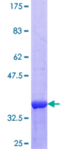 Abnova Human MULK Partial ORF (NP_060708.1, 31 a.a. - 125 a.a.) Recombinant Protein with GST-tag at N-terminal 25 &mu;g | Buy Online | Abnova&trade; | Fisher Scientific