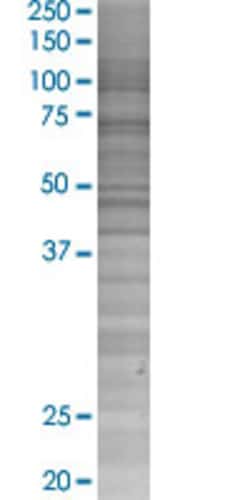 Abnova RIOK2 293T Cell Transient Overexpression Lysate (Denatured) (T02) 100 &mu;L | Buy Online | Abnova&trade; | Fisher Scientific