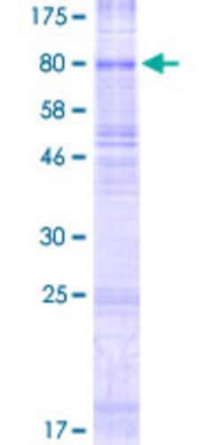 Abnova™ Human SLC22A11 Full-length ORF (NP_060954.1, 1 a.a. - 550 a.a.) Recombinant Protein with GST-tag at N-terminal