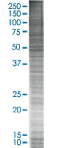 Abnova&trade;&nbsp;GPRC5C 293T Cell Transient Overexpression Lysate (Denatured)