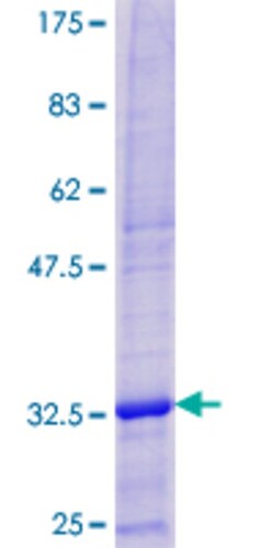 Abnova™ Human DEFB103A Full-length ORF (NP_061131.1, 1 a.a. - 67 a.a.) Recombinant Protein with GST-tag at N-terminal