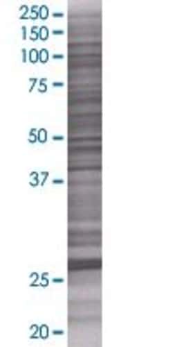 Abnova KIAA1166 293T Cell Transient Overexpression Lysate (Denatured) 100 &mu;l | Buy Online | Abnova&trade; | Fisher Scientific