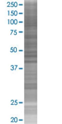 Abnova CFC1 293T Cell Transient Overexpression Lysate (Denatured) (T02) 100 &mu;L | Buy Online | Abnova&trade; | Fisher Scientific