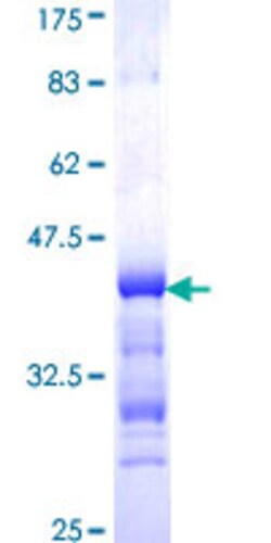 Abnova&trade;&nbsp;Human EIF4ENIF1 Partial ORF (NP_062817, 886 a.a. - 985 a.a.) Recombinant Protein with GST-tag at N-terminal 10&mu;g 