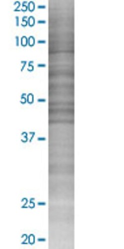 Abnova SHD 293T Cell Transient Overexpression Lysate (Denatured) 100 &mu;L | Buy Online | Abnova&trade; | Fisher Scientific