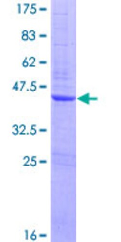 Abnova Human ZNF695 Full-length ORF (AAH23527.1, 1 a.a. - 133 a.a.) Recombinant Protein with GST-tag at N-terminal 25 &mu;g | Buy Online | Abnova&trade; | Fisher Scientific