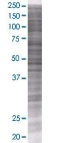 Abnova DAZ4 293T Cell Transient Overexpression Lysate (Denatured) 100 &mu;L | Buy Online | Abnova&trade; | Fisher Scientific
