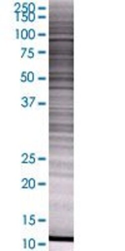 Abnova SCYL3 293T Cell Transient Overexpression Lysate (Denatured) 100 &mu;L | Buy Online | Abnova&trade; | Fisher Scientific