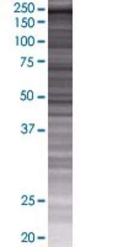 Abnova ZNFX1 293T Cell Transient Overexpression Lysate (Denatured) 100 &mu;L | Buy Online | Abnova&trade; | Fisher Scientific