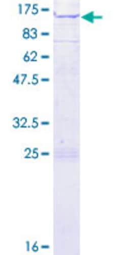 Abnova Human SNX14 Full-length ORF (NP_065201.1, 1 a.a. - 893 a.a.) Recombinant Protein with GST-tag at N-terminal 2 &mu;g | Buy Online | Abnova&trade; | Fisher Scientific