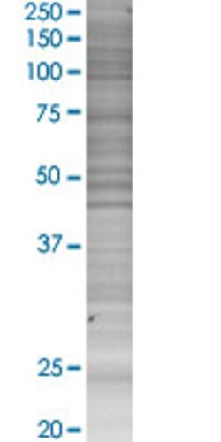 Abnova AICDA 293T Cell Transient Overexpression Lysate (Denatured) 100 &mu;L | Buy Online | Abnova&trade; | Fisher Scientific