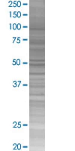 Abnova TMEM27 293T Cell Transient Overexpression Lysate (Denatured) (T02) 100 &mu;L | Buy Online | Abnova&trade; | Fisher Scientific