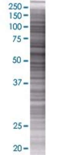 Abnova GALNTL1 293T Cell Transient Overexpression Lysate (Denatured) 100