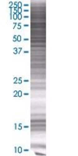 Abnova ZNF319 293T Cell Transient Overexpression Lysate (Denatured) 100 &mu;L | Buy Online | Abnova&trade; | Fisher Scientific