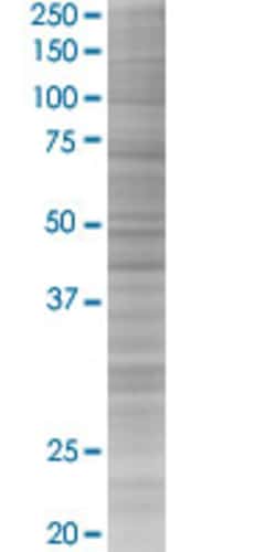 Abnova KIAA1456 293T Cell Transient Overexpression Lysate (Denatured) (T03) 100 &mu;l | Buy Online | Abnova&trade; | Fisher Scientific
