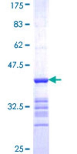Abnova Human SEMA4G Partial ORF (NP_060363, 24 a.a. - 115 a.a.) Recombinant Protein with GST-tag at N-terminal 25 &mu;g | Buy Online | Abnova&trade; | Fisher Scientific