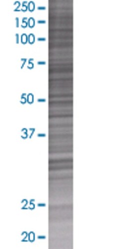 Abnova&trade;&nbsp;HES4 293T Cell Transient Overexpression Lysate (Denatured)