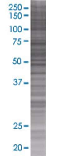 Abnova OXCT2 293T Cell Transient Overexpression Lysate (Denatured) 100 &mu;L | Buy Online | Abnova&trade; | Fisher Scientific