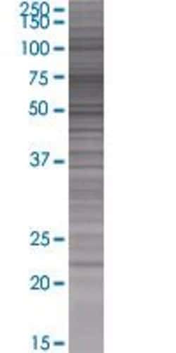 Abnova POPDC2 293T Cell Transient Overexpression Lysate (Denatured) (T01) 100 &mu;L | Buy Online | Abnova&trade; | Fisher Scientific