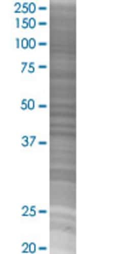Abnova EFCBP1 293T Cell Transient Overexpression Lysate (Denatured) (T02) 100 &mu;L | Buy Online | Abnova&trade; | Fisher Scientific