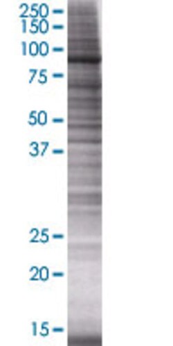 Abnova VPS16 293T Cell Transient Overexpression Lysate (Denatured) 100 &mu;L | Buy Online | Abnova&trade; | Fisher Scientific