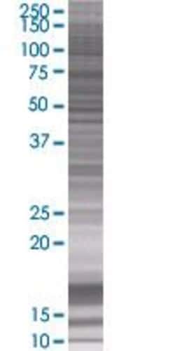 Abnova S100PBP 293T Cell Transient Overexpression Lysate (Denatured) (T01) 100 &mu;L | Buy Online | Abnova&trade; | Fisher Scientific