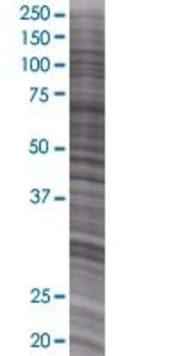 Abnova RABL5 293T Cell Transient Overexpression Lysate (Denatured) 100 &mu;L | Buy Online | Abnova&trade; | Fisher Scientific