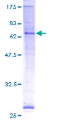 Abnova Human PORCN Full-length ORF (AAH19080, 1 a.a. - 456 a.a.) Recombinant Protein with GST-tag at N-terminal 2 &mu;g | Buy Online | Abnova&trade; | Fisher Scientific