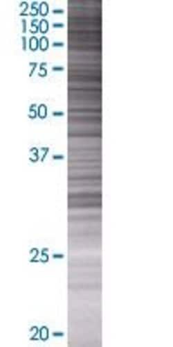 Abnova&trade;&nbsp;C1orf80 293T Cell Transient Overexpression Lysate (Denatured)