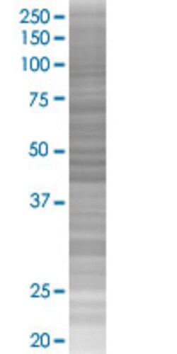 Abnova TTC23 293T Cell Transient Overexpression Lysate (Denatured) (T02) 100 &mu;L | Buy Online | Abnova&trade; | Fisher Scientific