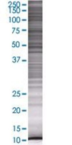 Abnova MRPS6 293T Cell Transient Overexpression Lysate (Denatured) 100 &mu;L | Buy Online | Abnova&trade; | Fisher Scientific